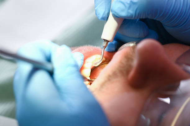 Best Emergency Dentist for Knocked-Out Tooth in Duquesne, MO